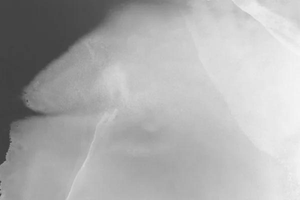 The Process of Bone Healing with Orthopedic Implants